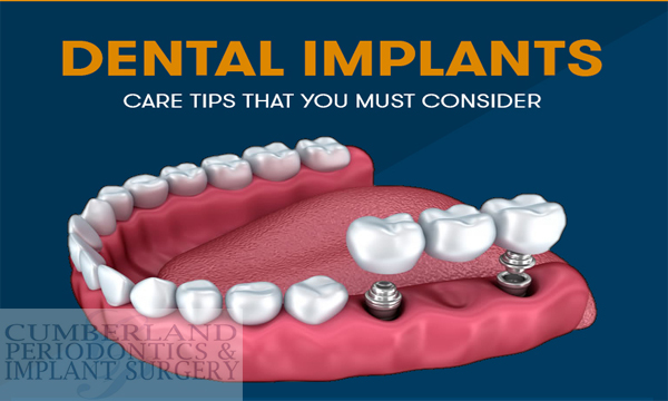 Dental Implants Care Tips That You Must Considers